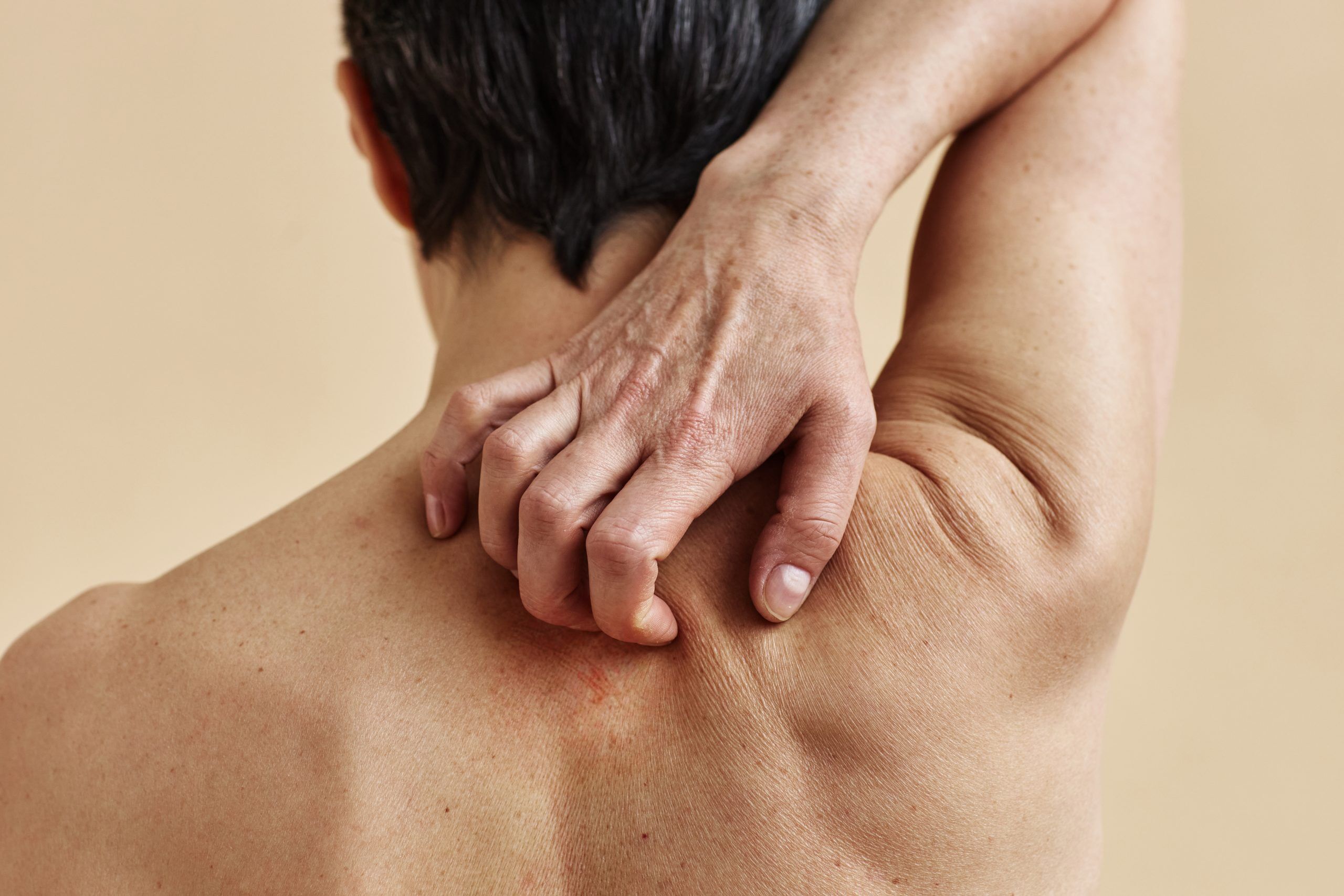 A woman with upper back pain, leading to the question "Can scoliosis cause pain in the upper back?"